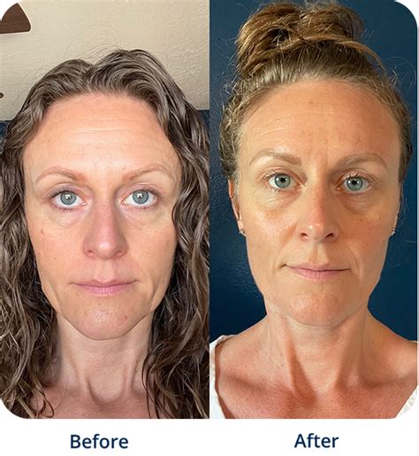 Buy DMAE Online – DMAE Firming Gel Skincare | AgelessRx