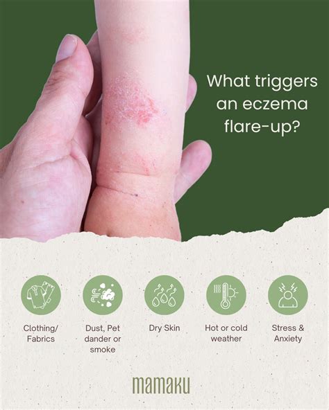 What triggers an eczema flare-up – mamakuskin