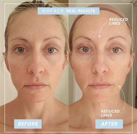 facegym  nuface  jennifer buffum blog