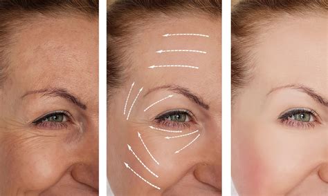 achieving bright clear skin   skin story pigmentation correcto