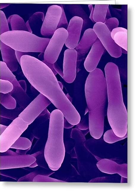 Clostridium Sporogenes Photograph by Dennis Kunkel Microscopy/science ... 