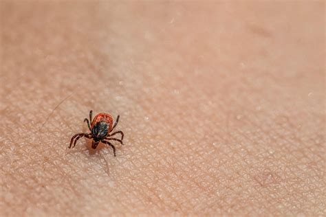 Don't let ticks take a bite out of warm weather fun - Cheyenne Laramie