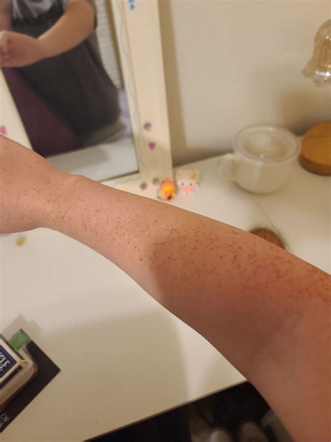 5 Simple Steps To Bring Freckles To Life On Paper