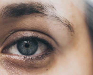 Eyelid Twitch: Causes, Remedies, and How to Prevent It