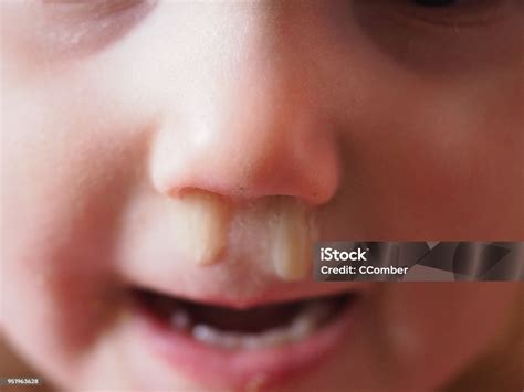 booger snotty nose child stock photo  image  nasal mucus