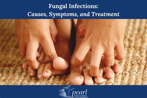 fungal infections  symptoms  treatment pearl foot  ankle