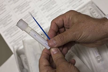 Different Types of STD Testing Kits | Sexual Health Online Information