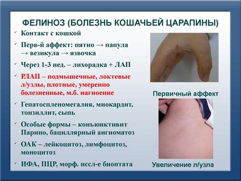 Дифференциальная диагностика заболеваний, сопровождающихся развитием ...