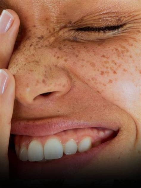 how to make gums stronger