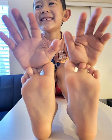 "Mommy, why do my hands... - Happy Skin Pediatric Dermatology | Facebook