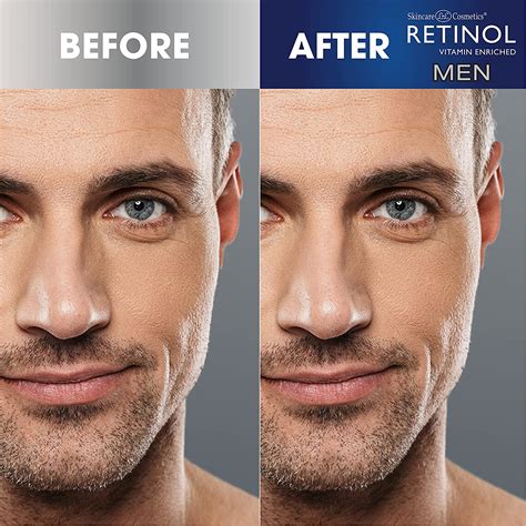 facial for men 6