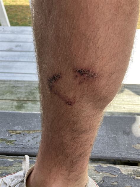 river eel bite  victoria mcbrien blog