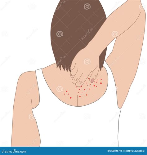 Itch Scratch Cycle Hands Illustration. Dry, Dermatitis And Atopic