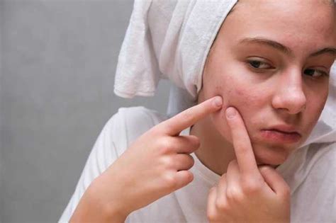 "Клензит С" от прыщей - подробная инструкция, отзывы и эффективное ...