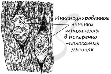 Класс нематоды, подготовка к ЕГЭ по биологии