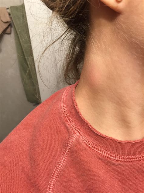 Weird symptoms – Megan of the Mountains