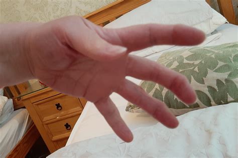 Spasms in hand. Does anyone get these? : r/Thritis