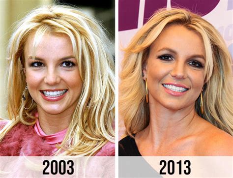 Britney Spears Plastic Surgery