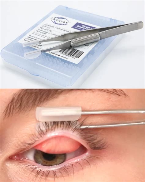 single hand eyelid eversion tool  mg assessment