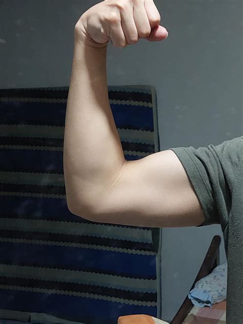 Other arm's bicep tendon more visible than the other, should I be