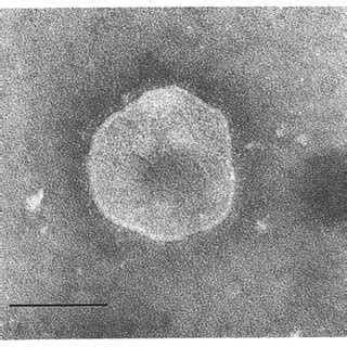 PTA staining of placental ERV particle. Bar = 100 Ipm. FIG. 2. PTA ...