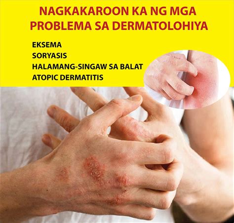 Atoderma - Nagpapabuti ng psoriatic na balat, parakeratosis