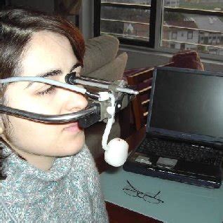 posselts diagram frontal view image  weingaertner