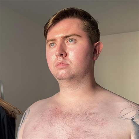 Why is my face so shiny, greasy etc in comparison to the rest of my