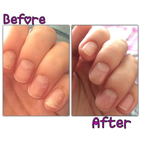 how to get glue on nails off 7