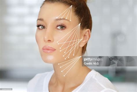 Thread Lift Nonsurgical Procedurelower Facelift High-Res Stock Photo ...