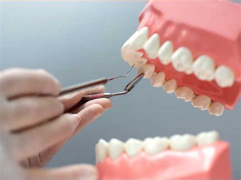 dental clinic hospital  udumalpettai  dentist udumalai