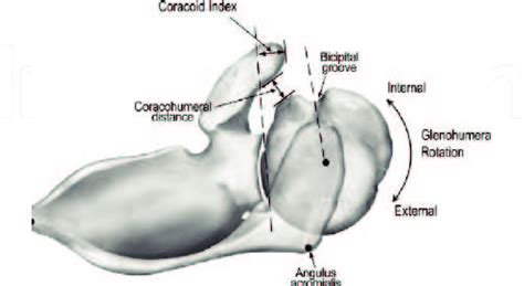 coracoid impingement  scientific diagram