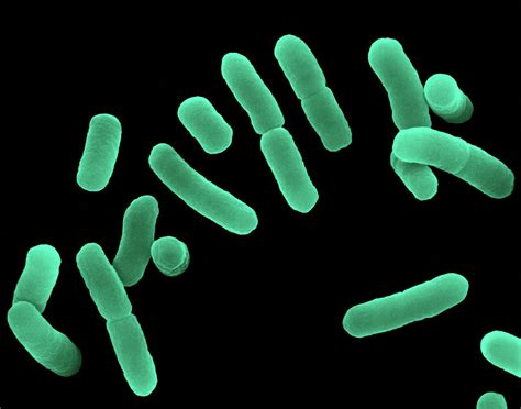 Lactobacillus Sp O Que É - Lactobacillus Sp Como Se Pega - BRAINCP