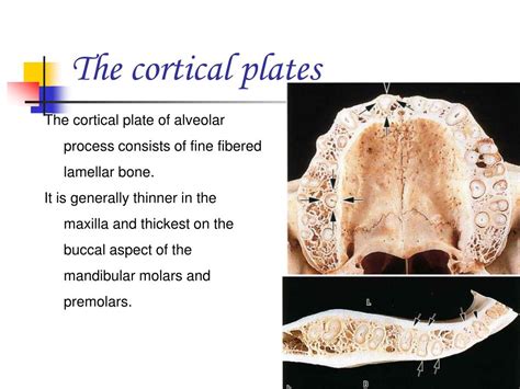 PPT - Pre-clinical Periodontics PowerPoint Presentation, free download