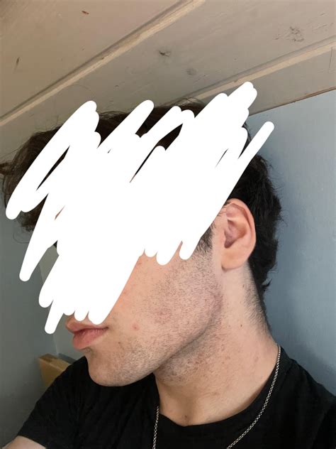 Skin/tissue under jawline hiding it : r/Mewing