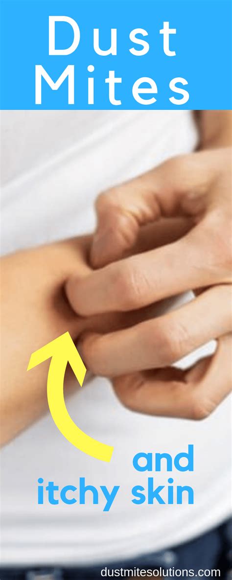 Dust Mite Allergy Symptoms: Itchy Skin | How I Manage My Allergy