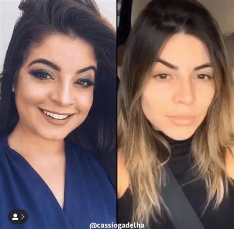 Antes E Depois Gkay - Influenciadora Gkay gasta fortuna para desfazer harmonização facial e ...