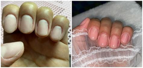 Blindagem De Unha Antes E Depois