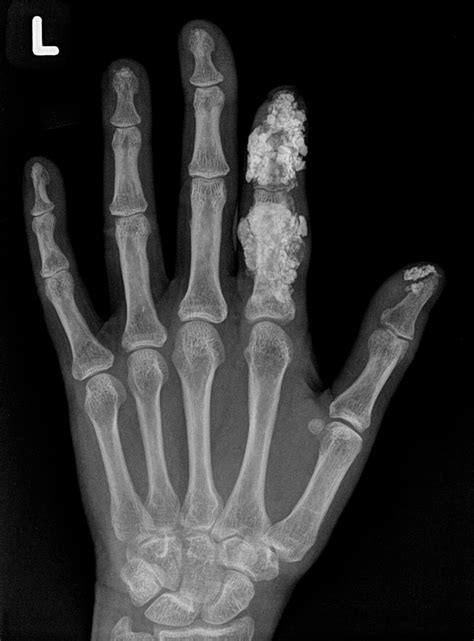 imaging features