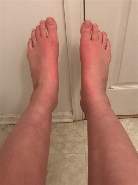 red color on bottom of feet 4