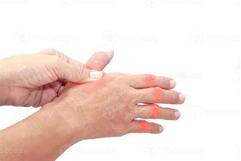 Woman finger suffering from knuckle pain on white background