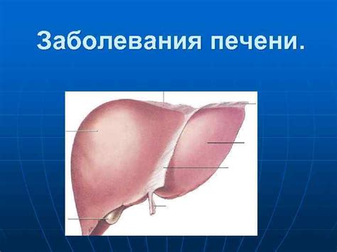Заболевания печени. Основные симптомы и синдромы