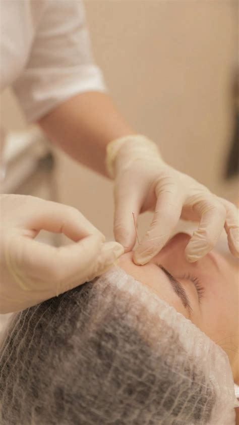 Acupuncture Videos, Download The BEST Free 4k Stock Video Footage