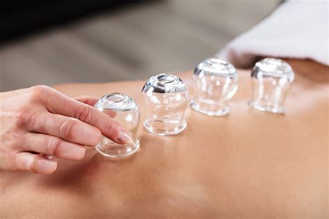 cupping         treatment aaptiv