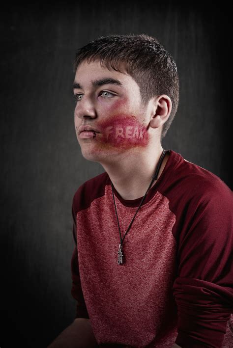 Weapon Of Choice: Shocking Project Shows That Words Hurt As Much As ...