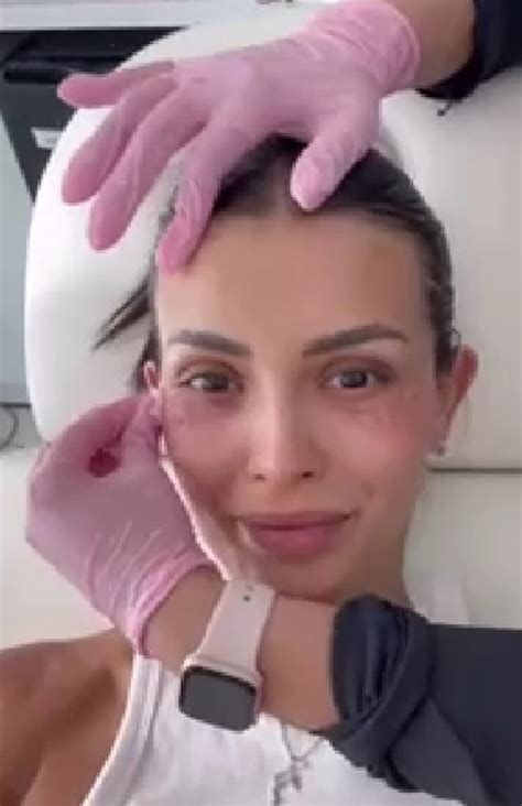 Cony Capelli revela curioso tratamiento estético de esperma de salmón