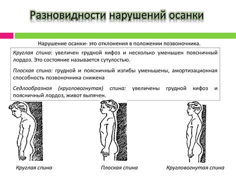 Профилактика и лечение нарушения осанки и сколиоза у детей ...