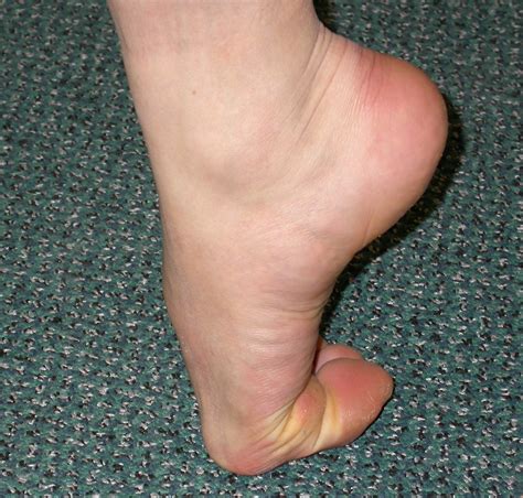 big toe inflammation