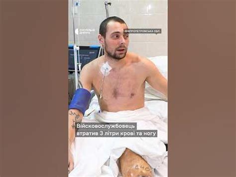 «Від ноги залишилися лише шматки шкіри» У медзакладі лікують ...