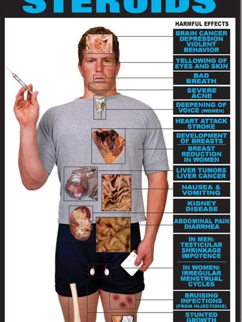 Anabolic Steroid Side Effects